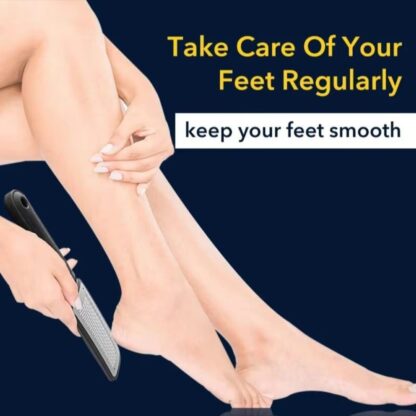 Foot File Scraper Rasp Hard Dead Dry Skin Remover Grater Callus Pedicure Black - Image 3