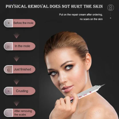 Laser Plasma Pen for Skin Tag Tattoo Removal Mole Black Dots Remover 9 Level LCD Laser Pen Facial Cleaning Beauty Care Tools - Image 4
