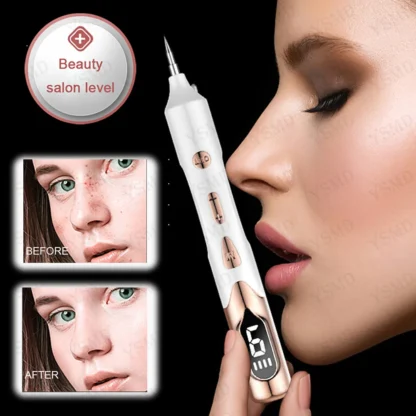 Laser Plasma Pen for Skin Tag Tattoo Removal Mole Black Dots Remover 9 Level LCD Laser Pen Facial Cleaning Beauty Care Tools - Image 2