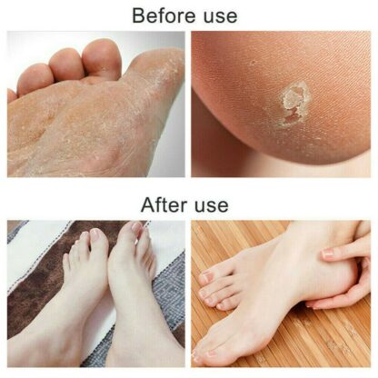 Foot File Scraper Rasp Hard Dead Dry Skin Remover Grater Callus Pedicure Black - Image 10